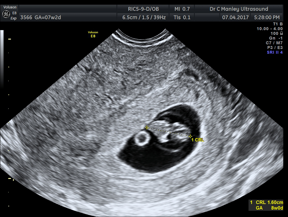 Launceston Gynaecology: Ultrasound